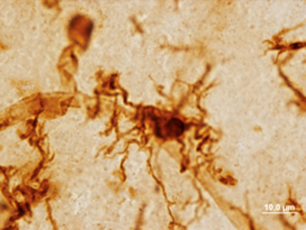 Activated microglia microscopy from the publication