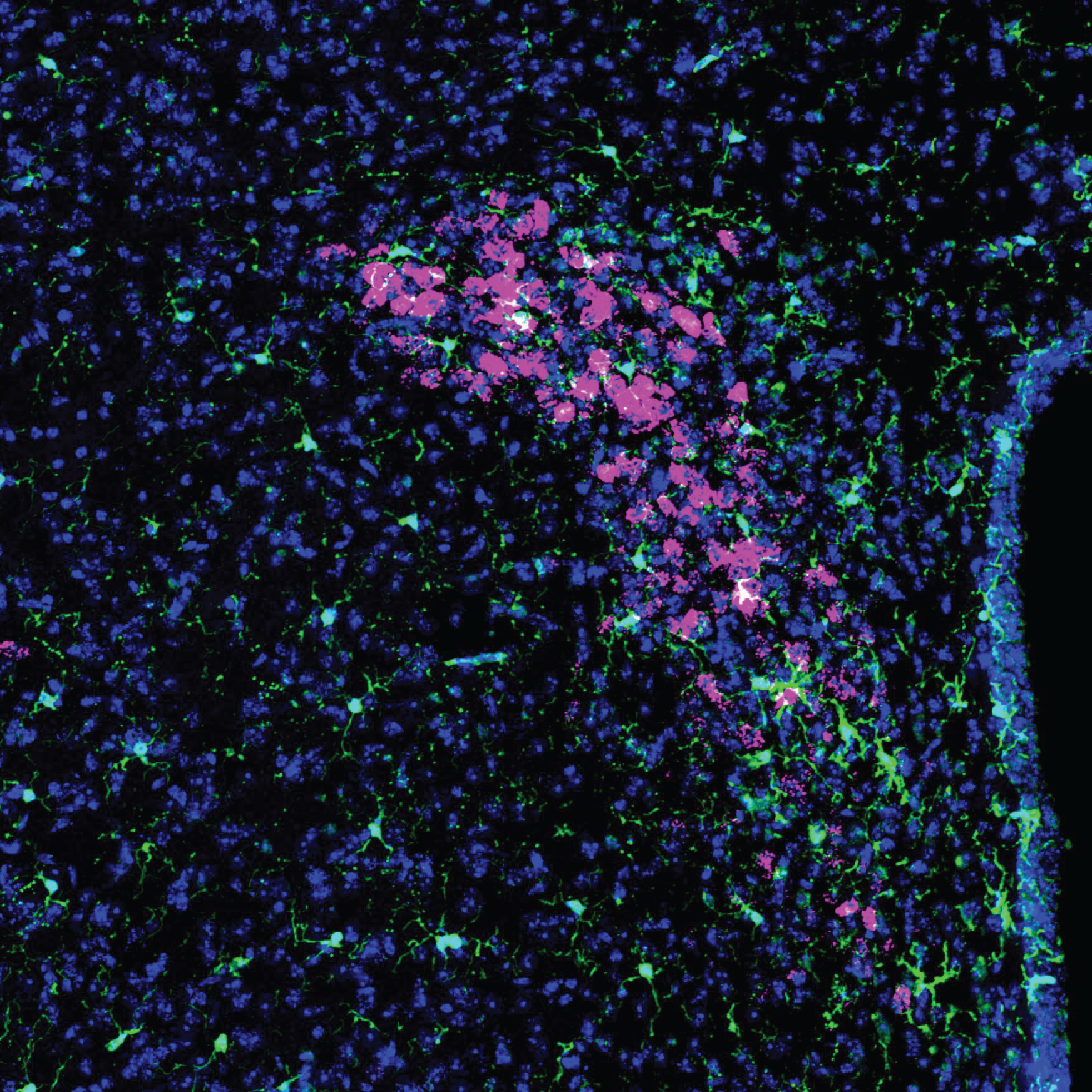 Fluorescence microscopy image showing labeled cells in brain tissue